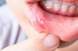 Doktordan Covid-19 uyarısı: Ağzınıza dikkatli bakın belirti çıkabilir