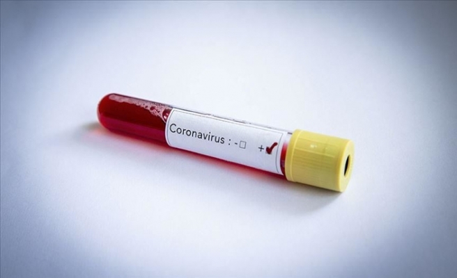 Belarus'ta 4 Kişide Yeni Tip Koronavirüs Kovid-19 Tespit Edildi