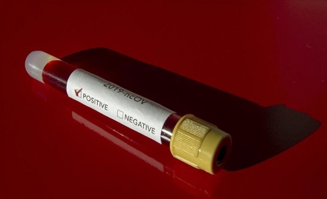Koronavirüs Test Sonuçlarına eNabız'dan Ulaşılabilecek