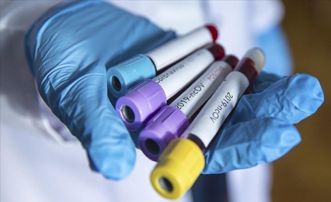 Yeni Tip Koronavirüs Nedeniyle Hayatını Kaybedenlerin Sayısı 10 Bini Aştı